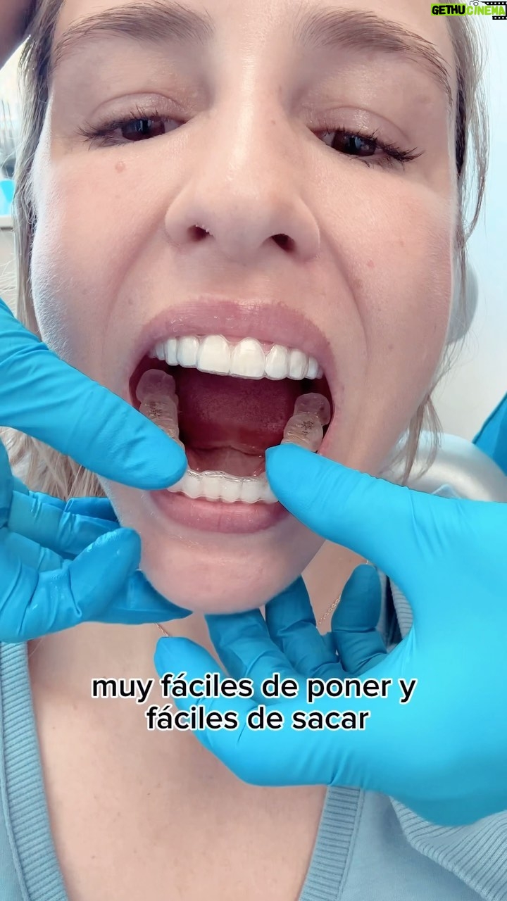 Valeria Ortega Instagram - Estoy en 🔥 porque empecé mi tratamiento con @invisalignlatam en @clinicaismile con la máxima @docbarb_ismile Usé brackets hace años, pero esta tecnología es otro nivel!! Se pasó! Es maravilloso! Llevo una semana y voy como avión. Me los saco para comer, luego me lavo los dientes y lavo los alineadores (prefiero tener un cepillo aparte). Duermo con ellos y no se sienten (y yo con bruxismo!). Hasta podemos adelantar como se van a ver al final del tratamiento. La próxima semana tengo otro chequeo y ahí veré que tal avanzamos. Ya no ceseo tanto 😂 me acostumbré rápido ✨🦷 ✨