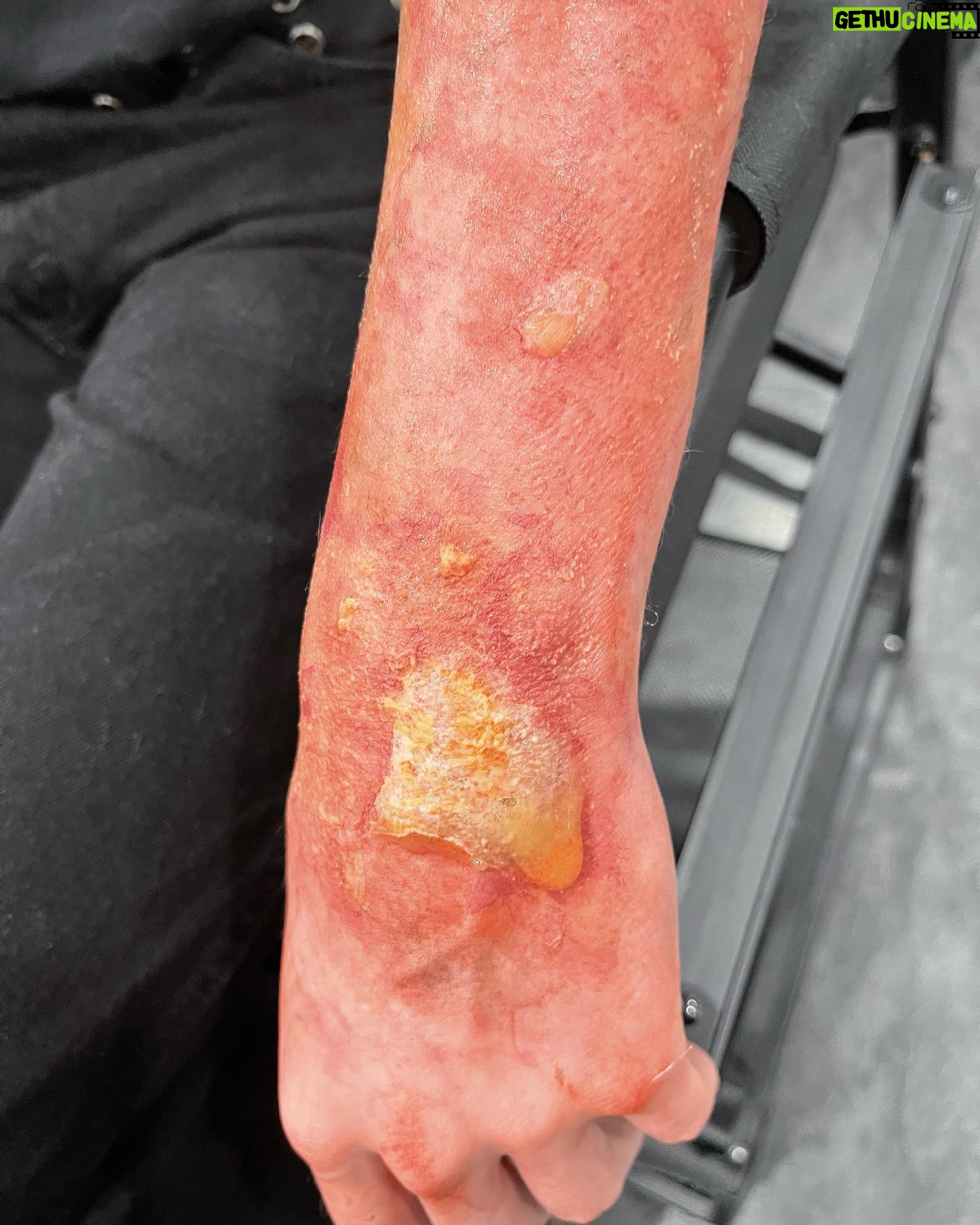 Ve Neill Instagram - Some demos I did for the trauma class @legendsmakeupacademy β¨ Sign up for Classes ππΌππΌππΌππΌ legendsmakeup.com β’β’β’β’β’β’β’β’β’β’β’ @legendsmakeupacademy @vesfavoritebrushes @therealve #makeup #specialeffects #specialeffectsmakeup #makeuptutorial #makeupartist #traumamakeup #veneill #legendsmakeup #fx #fxmakeup #sfxmakeup #sfx #mua #makeupmua