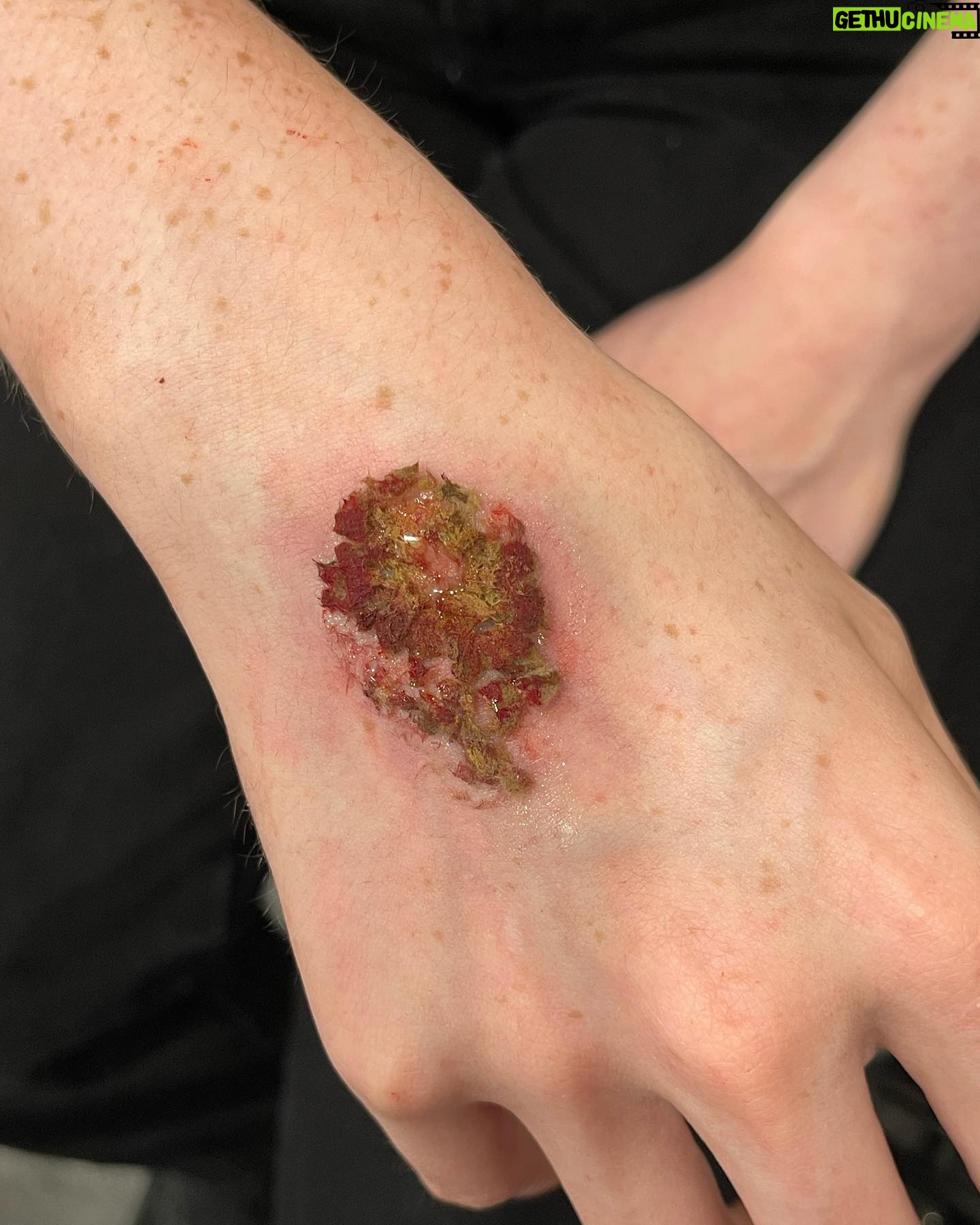 Ve Neill Instagram - Some demos I did for the trauma class @legendsmakeupacademy β¨ Sign up for Classes ππΌππΌππΌππΌ legendsmakeup.com β’β’β’β’β’β’β’β’β’β’β’ @legendsmakeupacademy @vesfavoritebrushes @therealve #makeup #specialeffects #specialeffectsmakeup #makeuptutorial #makeupartist #traumamakeup #veneill #legendsmakeup #fx #fxmakeup #sfxmakeup #sfx #mua #makeupmua