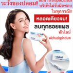 Vichuda Pindum Instagram - 💥Promotion ราคาพิเศษ หมดแล้วหมดเลย💥 . Kelosil 3 หลอด จากปกติราคา 2,900.- 💙พิเศษ 3 หลอด 999.-💙 พร้อมจัดส่งฟรี 👉🔴 ทักไลน์ wichudapindum 🔴 🔥🔥Promotion พิเศษฉลอง 20 ปี🔥🔥 Kelosil ลดรอยแผลเป็น‼ เจลลดรอยแผลเป็นแบบ “ เคลือบ “ !!!! ท้าให้ลอง👍🏻💗 . สามารถทาที่ไหนได้บ้าง ❓ ✅ แผลคีลอยด์ ✅ แผลเป็นทุกชนิด ✅ แผลพุพอง(ที่หายสนิทแล้ว) ✅ แผลผ่าตัด ✅ แผลหลุมสิว ✅ แผลนูนแดง ✅ แผลจากอุบัติเหตุ