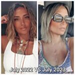 Yasmine Ghaith Instagram - Last year's neck situation VS this year's!! Can't wear any necklace till god knows when 🤷🏽‍♀️ الصيف اللي فات VS الصيف ده...سلاسل كتييييير VS ولا واحدة حتي عارفة ألبسها! 🤷🏽‍♀️ الحمد لله 😄💙🙏🏾 #NewScar #WonderWomanTheyCallMe
