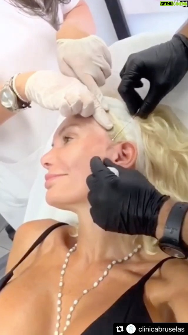 Yola Berrocal Instagram - Cris Oyola me pone hilos tensores, muy feliz con el resultado y sin dolor.