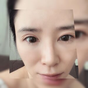 Yuu Tejima Instagram - ・
　

てじっ子が体調崩して看病していたら寝不足などなどから　　
　
　
　

…目が三重になりました。

　
　
　

完全に歳ですね。

瞼のたるみ…実感👀　
　
　

ちなみに私は感染などもせず人相変わったくらいでめちゃくちゃ元気です✌️
　
　

私の見た目はどーでも良いのでとにかくてじっ子が早く元気になって欲しいです😢

でもとりあえずここまでまぶた凹むのもレアだったので記念に📷残しておきます。　
　
　
　
　
　

#アラフォー　#アラフォーママ  #瞼のたるみ  #現実
#お疲れ顔 #子どもの看病　#私は元気です　#頑張ります