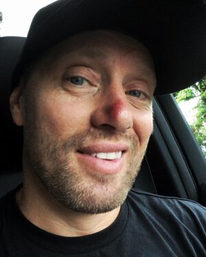 Aksel Hennie Instagram - They see me Rollin’... #bjj #nosejob #rudolph @frontlineacademy @andersflatlalaland 😘