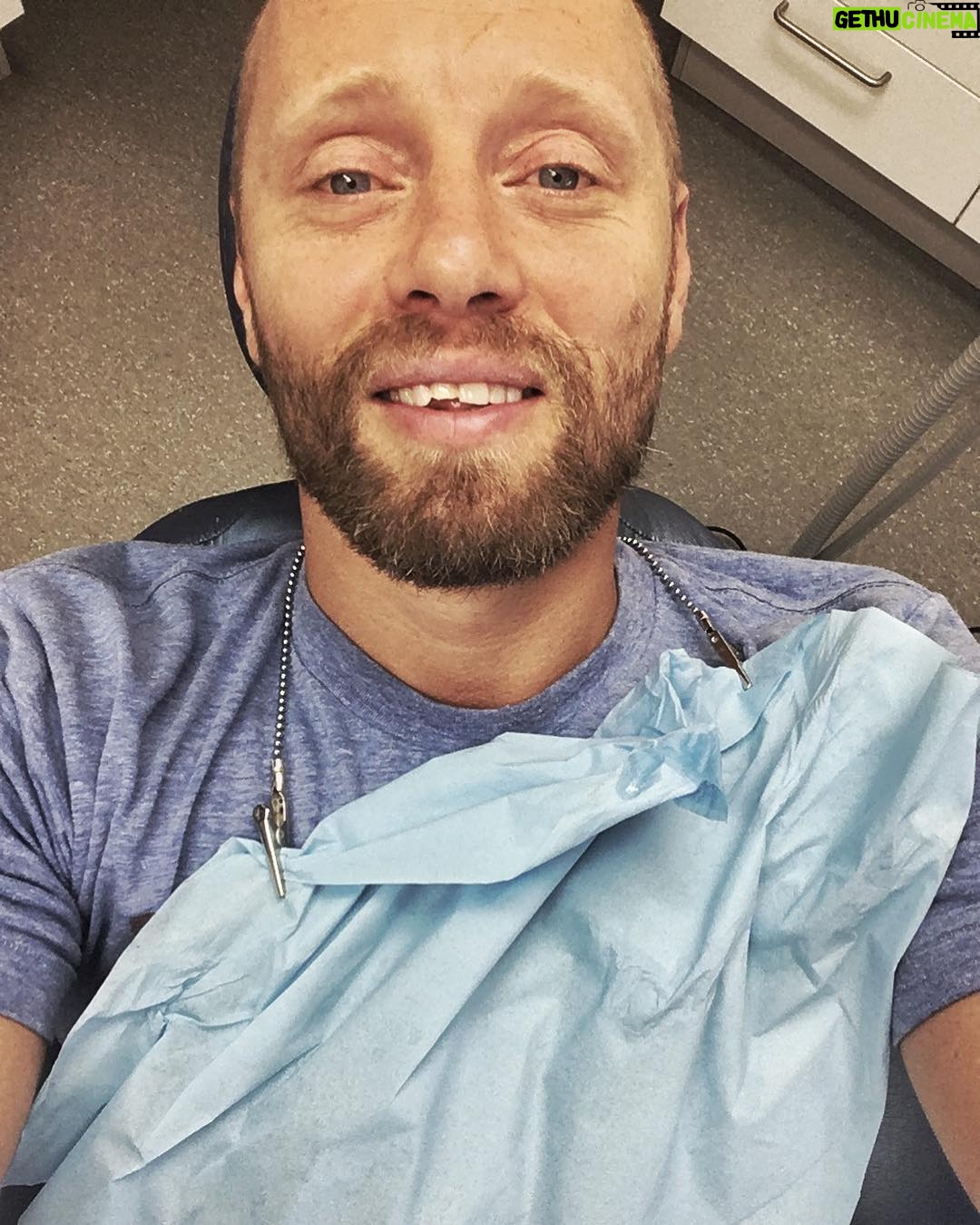 Aksel Hennie - 3.5K Likes - 😁 FRONT TEETH GAP TIME! 😁 For the next project you will see me in, I went through a crazy transformation that I can’t wait to show you, guys! Until that movie premieres I’m not allowed to show you the result, but this week we’re doing some additional shooting, so here I am again at my dentist chipping off parts off my teeths to get the right diastema for the guy I’m playing.... ps; I would like to thank the guy that punched my face back in the days and made it easier for me to get the right look for this part... ❤️ #tannlegeneivika #artpro @gadinjoz #movie #moviemaking #dentaltransformation