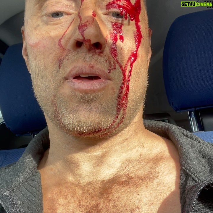 Aksel Hennie - 5.7K Likes - ACCIDENT ON SET! ….just another example on the obvious fact that life is filled with risk. We can try to blame ourselves or others, make rules or whatever else to try to regulate consequences of our actions, but accidents will continue to happen as long as human beings are involved… #life #sisu #shootingmovies #actorlife