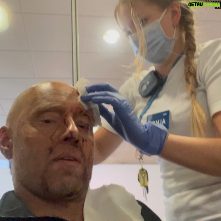 Aksel Hennie - 5.7K Likes - ACCIDENT ON SET! ….just another example on the obvious fact that life is filled with risk. We can try to blame ourselves or others, make rules or whatever else to try to regulate consequences of our actions, but accidents will continue to happen as long as human beings are involved… #life #sisu #shootingmovies #actorlife