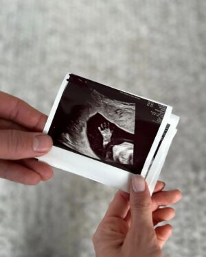Aksel Lund Svindal Instagram - Can't wait to high five this little guy sometime around September😍😃👊 And @amalieiuel is absolutely amazing❤