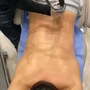 Alejandro Otero Instagram - Hora de eliminar definitivamente algunos pelitos que ya no quiero tener, no mas cortadas con máquina 🤪🤣🤣🤣🎉🎉🎉 @semperlaserco Contáctalos y agenda tu primera sesión GRATIS

Bogotá
📍El Retiro Shopping Center  57 (321) 8762230
📍Centro Comercial Andino  57 (314) 5897741
📍Centro Comercial Multiplaza  57 (321) 2722088
📍San Roque Distrito Local, Cajicá  57 (314) 3064219

Medellín
📍Amsterdam Plaza  57 (310) 5436359
.
.
.
.
.
.
#SemperLaserCo #SemperLaser #DrZabaleta #Candela #GentleMaxPro #nomasvello #hairfree #laserhairremoval #depilacióndefinitiva #unisex #estetica #dermatologia #dermatologo #tratamientos #tratamientoscorporales  #depilacion #depilacionlaser #laserbogota #foliculitis #pelos #vellos