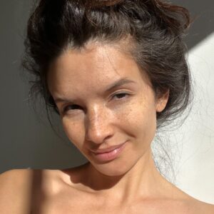 Alice Greczyn Instagram - Bare-skinned and unfiltered! 😌 My blog post on how I cured my #perioraldermatitis remains one of my most widely shared. Each time it has a viral moment, my DMs blow up with two questions: How has my skin maintained nearly two years later? What products do I use on my face today? So, I gave the piece a little update!

👉🏼 Link in bio to “Unaccountable,” where you’ll find my updated blog post, “How I Cured My Perioral Dermatitis—The Skin Condition You’ve Never Heard Of and How I Learned to Manage Mine.” 

#nofilter #bareskin #perioraldermatitistreatment