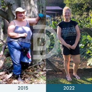 Andreas Eenfeldt Instagram - Virginia started the keto diet in 2018, following her physician’s advice to check out Diet Doctor. Within a year, she had lost over 90 pounds (41 kilos), reversed her type 2 diabetes, improved her mobility, and relieved her arthritis, and those are just some of the incredible changes she noticed! 🙌 ⁠
⁠
But since then, Virginia’s had a few ups and downs. Her love for keto desserts re-triggered her sugar addiction, causing her to regain some of the weight she had lost.⁠
⁠
Not one to give up, Virginia made a conscious decision to change her method. She added more protein and fiber to her diet, avoided keto desserts, and tried the higher-satiety eating (HSE) approach; this was the key to her new-found success! 🔑 ⁠
⁠
Read Virginia’s full story in the link in our bio 👉 @diet_doctor⁠