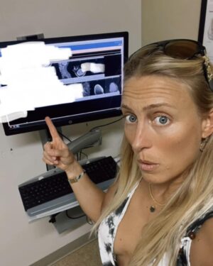 Angelique Kenney Instagram - So this was yesterday ❤️‍🩹🙈💪🏽… oh oh 😥 

… yeah that’s a rare #selfie … 🤷🏼‍♀️ uh hello 👋 😉 

#nomakeup
#longhairdontcare #nofilter #beachbabe #bonjour #mermaid #endlesssummer #sunkissed #blondie #blueeyes #romper #mri #surgery #fml #positivevibes #fashionista #caraccident