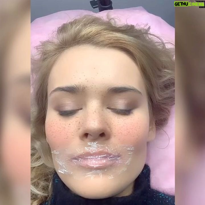 Anna Klinskaya - 778 Likes - #PRO 💄перманентный макияж
Долгожданный пост.
Прошло достаточно времени и я готова искренне поделиться своими впечатлениями….
Задала важные вопросы моему мастеру Ольге, @pm_knyazeva 🥰
👄ТАТУАЖ И ПЕРМАНЕНТНЫЙ МАКИЯЖ РАЗНИЦА?
Татуаж - это татуировка, которая делается на всегда и ее очень сложно вывести, если тебе надоело.
Перманентный макияж - держится от 2 до 6 лет. Делается менее болезненно и пигмент вводят в верхние сои кожи.
ПРОТИВОПОКАЗАНИЯ
- беременность
- вирусные заболевания
- плохая свертываемость крови
- рак, ВИЧ, воспаления
- на время лечение антибиотиками
👄ПОДГОТОВКА К ПРОЦЕДУРЕ:
- до процедуры нужно отказаться от алкоголя, энергетических напитков
- если у вас бывает герпес, пропить лекарства устраняющие его( ацикловир, герпевир)
- за несколько дней не принимать аспирин, антибиотики, применять перекись водорода, спиртосодержащие препараты
- губы не должны быть сухими, наращенные ресницы сняты, косметические процедуры не рекомендуется выполнять на брови(покраска, скрабирование, пилинги)
👄 НА ЧТО ОБРАТИТЬ ВНИМАНИЕ ПЕРЕД ПРОЦЕДУРОЙ?
- перманентный макияж не увеличивает губы и не меняет форму, максимум 1-2 мм
- опытный ли перед вами специалист
- обязательно обратить внимание на иголку ( она должна вскрываться перед вами)
- обговорить цвет и силу
👄ПОСЛЕ ПРОЦЕДУРЫ?
- в хорошем салоне вам дают средства по уходу за губами
- 2-3 недели нельзя загорать
- 2-3 недели нельзя пользоваться макияжем
👄КОРРЕКЦИЯ?
- советую сразу рассчитывать на коррекцию - первую процедуру лучше делать не очень ярко, что бы не расстроиться потом
- она нужна для того, что бы заполнить те места пигментов, что кожа не приняла после первой процедуры
- специалист не знает специфику вашей кожи, имунитета и с первого раза может не получиться тот эффект, что вы хотите
- делается через 1мес - 1,5 мес
👄МОИ ВПЕЧАТЛЕНИЯ В КАРУСЕЛИ ➡️