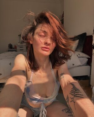 Anthony Lexa Instagram - soaking the (flaky) skin in the sun☀️🤍