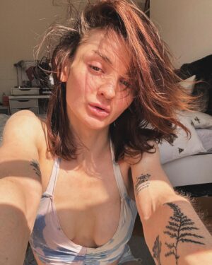 Anthony Lexa Instagram - soaking the (flaky) skin in the sun☀️🤍