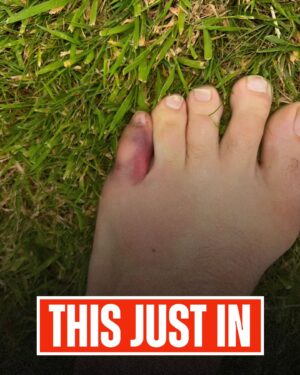 Ariel Helwani Instagram - Conor McGregor reveals he suffered a broken toe, which led to him having to withdraw from 303. Same leg that he broke versus Poirier in 2021. “It needs a few weeks that’s it,” he wrote. 

(h/t @thenotoriousmma)