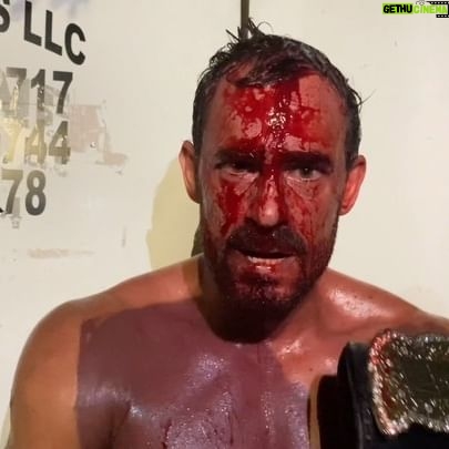 Ariel Levy - 1.9K Likes - After his victory in a brutal steel cage match against Alan Martinez, CCW World Heavyweight Champion @ariel_levy shares his thoughts on his upcoming title match in Port St. Lucie.
This Friday, Ariel defends against @itschachatime, @english.big, and @alans2s at the @midfloridaeventcenter when CCW presents ST. LUCIE SHOWDOWN!
Tickets are on sale now and selling fast! We’ll see you there!
🎟️: CCWrestlingFL.com
#CCW #CCWAlive #PortStLucie #TreasureCoast #ProWrestling #PortStLucieFL #FortPierce #StLucieCounty #IndyWrestling #Chilean #Actor #Superstar