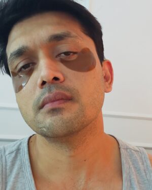 Arifin Shuvo Instagram - Low BP = mejaj kharap   weak   nai kaj tou eye patch  bedana   saline  netflix  mejaj kharap.😭

Let me know amar r ki ki Kore mejaj kharap kora dorkar 😞