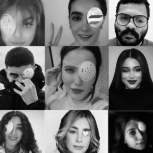 Artemis Pebdani Instagram - RP• @afshinismaeli Hundreds of young Protesters in Iran Blinded by Metal Pellets and Rubber Bullets during Iran protests. 

Security forces have been firing ammunition that has ruptured the eyes of antigovernment demonstrators in the past four months. 

“When you shot me from a two meters distance & smiled, did you think I would survive & answer your smile?!” Says 
Ghazal Ranjkesh
, who lost an eye to pellet bullets during the protests in Iran.

Kowsar Khoshnoodi Kia, a member of Iran’s Women’s National Archery Team who has won medals in national and international competitions. She recently appeared in a video, explaining how she had lost sight in one eye when security forces fired at her.

Since the eruption of the uprising on 16 September 2022, according to human rights organizations Iran’s security forces have killed more than 500 protesters and injured 1000s in a bid to crush the protests.

Pictures: sosial media
