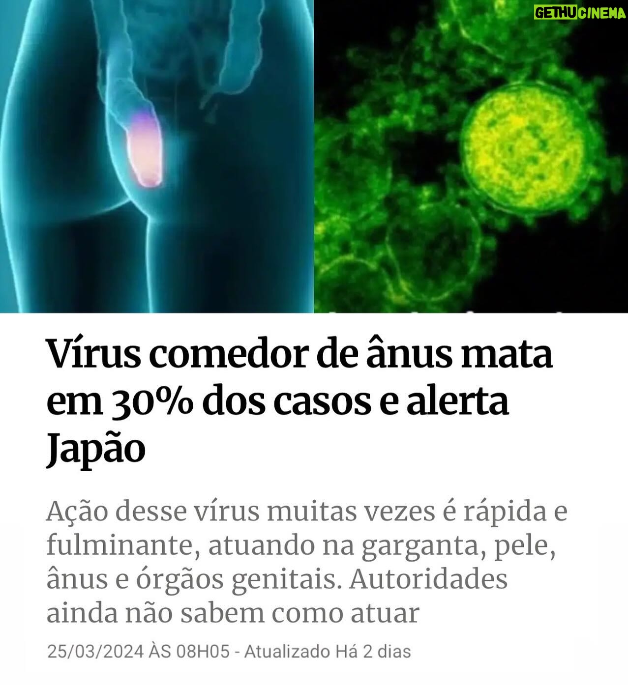 Arthur Morisson - 9.8K Likes - Primeiro um chinĆŖs comeu um morcego e deu merda.
Agora um vĆrus tĆ” comendo a bunda dos japoneses.
Mermão, esses asiÔticos tão fazendo alguma coisa errada.