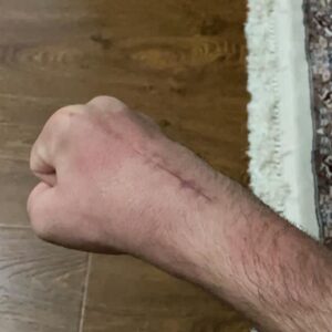 Askar Askarov Instagram - I welcome everyone. I thank everyone who asks and worries about me! I have already begun to smoothly enter the training process and in December, I will be ready to take the belt 🏆 from Brandon Moreno (@theassassinbaby). I want to say thank you to the UFCPI staff ✊🏻☝🏻
_____

Всех приветствую. Благодарю каждого, кто спрашивает и переживает за меня! Я уже начал плавно входить в тренировочный процесс и в декабре, буду готов забрать пояс🏆у Брендона Морено. Хочу сказать спасибо работникам UFCPI за помощь в реабилитации ✊🏻☝🏻