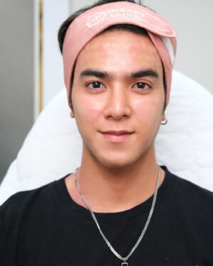 Aukkarat Jittasiri Instagram - วันนี้เข้ามาทำโปรแกรม Fresh Zell ที่ @theartclinicaesthetics เป็นตัวช่วยดูแลผิวเน้นฟื้นฟู กระตุ้นเซลล์ข้างในให้ทำงานมากขึ้น ซ่อมแซมและกระตุ้นการสร้างคอลลาเจนได้รวดเร็ว ช่วยบำรุงผิวแห้ง ลดเลือนริ้วรอยที่เกิดจากสิว ลดเลือนฝ้ากระจุดด่างดำ และทำให้ผิวแข็งแรงอีกด้วย ✨💕 
#theartclinic #freshzell #freshzelltheartclinic