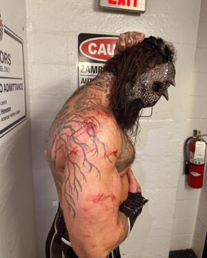 Austin Matelson Instagram - Last Wednesday on #aewdynamite I was left handcuffed and scarred by barbed wire. This week im at home recovering thanks to @drsam.wagz 

Watch @aew dynamite tonight live on TBS