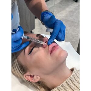 Barbora Balúchová Instagram - Ďakujem @skinklinik.sk pani doktorke Martinke Hlavatej💋 pre niekoho kontroverzná téma ale myslím si že keď si žena dopomôže s citom a profesionálnymi službami výsledok je dokonalý. Žiadna kačička zo mna za tie roky čo si chodím napichat, hydratovať pery nieje a tým že mám extrémnu mimiku sme doplnili aj botox do čela. Ďakujem @skinklinik.sk a ženy nezabúdajte pri takýchto zákrokoch sa neoplatí vybrať to najlacnejšie lebo to nemusí dopadnúť dobre.