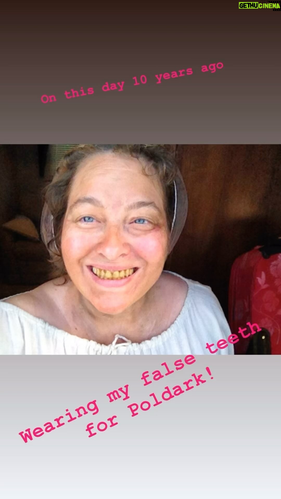Beatie Edney - 250 Likes - Wearing false teeth 10 years ago for my character Prudie in Poldark. #BTS #poldark #actorslife