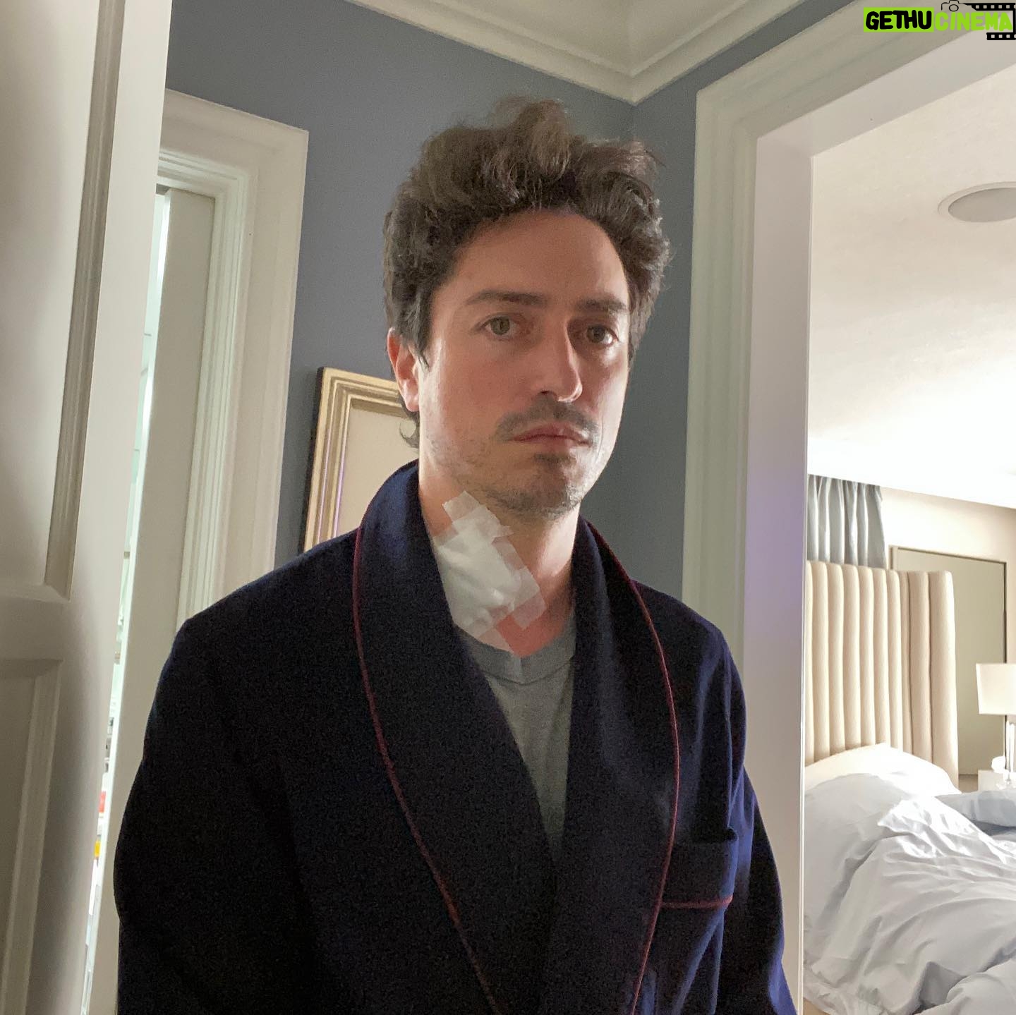 Ben Feldman - 34.4K Likes - So some Me news: on Monday, an incredible surgeon in Newport (dr Robert Bray) opened up my neck, drilled out some calcified bone & 2 shitty discs in my spine, popped in 2 artificial discs & sewed me back up. It was horrifying but I’m alive & lots of friends/family sending me food that I can swallow, which is a v underrated category of food (slippery). @michellehelyn is an incredible (& patient) nurse & sometimes when she’s unavailable, Charlie will bring his toy dr bag up to my room & give me a “shot”. Anyway things are good.