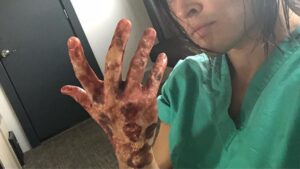 Blair Redford Instagram - Little BTS shenanigans from last nights @thegiftedonfox  episode. Seemed Halloween appropriate. Our SFX makeup team always killing it: @mark_nieman @coreymakeup