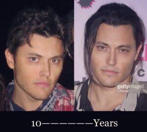 Blair Redford Instagram - A decade strong – still no smiling. 🤐🙌. These are almost #10yearchallenge to the day.
