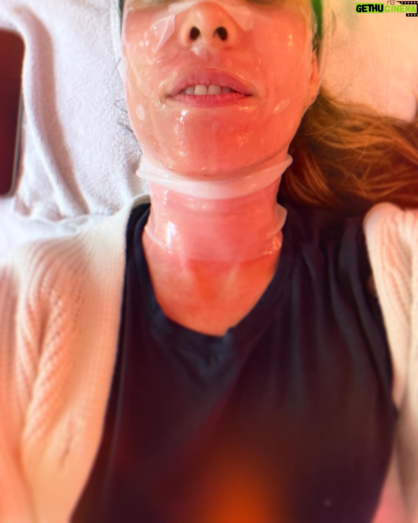 Carly Pope - 513 Likes - Pre/During/Post
“What does my Friday need,” I mused.
Def a trip to @sagelaneskincare for a #microneelding treatment to get my face that perfect shade of “coy red” for the weekend
Molly, you’re the best. Extra cuddles courtesy of Willie.
Come at me collagen 🫡 ♥️ #notox