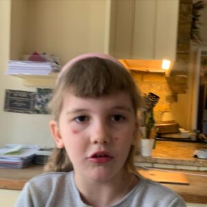Christie Clark Instagram - Oh boy, what a strange virus.  Officially, on the mend. Although, it’s still lurking in my throat area.  So, many folks have been affected near me.  Hope your all staying safe!  My daughter found a pair of scissors and cut her bangs/fringe yesterday and I wept with laughter anytime she walked into the room.  Everyone is calling her Tiger Queen. #coronavirus #uk