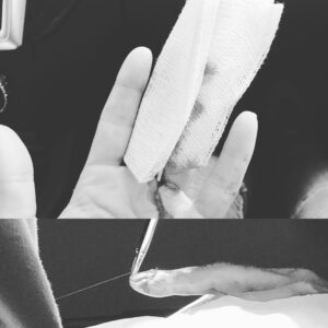 Claudia Black Instagram - I'm doing this in b&w for those who don't like blood. Partial amputation and a break. Dirt bike riding. It's my middle finger. Kinda sums up 2017. Awesome help from trauma 2 hospital Henry Mayo. Thank you staff for realizing that you can be cool and pretty calm and losing a decent portion of a finger. My triage was pretty damn swift once I took off the gauze. I have trauma training to thank for my composure. Grateful beyond words for Somatic Experiencing and those who are training me. Thanks also to my bff @kristelsellsre ( best finger friend) for all your help and the second photo. It's hurting like cray now though I'm still grateful as all heck. Could have been so much worse. Be safe this holiday. Be kind. Be adventurous yet intact. 🙏🏼💗🤞🏻🤷🏼‍♀️