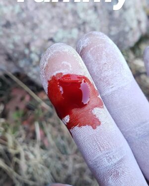 Daniel Woods Instagram - There will be blood

price u gotta pay sometimes in order to send. I mostly complain about my finger skin while climbing. The condition of it will truly make or break my confidence while trying hard. Such a small yet devastating injury 😂