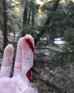 Daniel Woods Instagram - There will be blood

price u gotta pay sometimes in order to send. I mostly complain about my finger skin while climbing. The condition of it will truly make or break my confidence while trying hard. Such a small yet devastating injury 😂