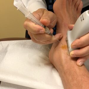 Danny Way Instagram - I have had 28 orthopedic surgeries now which 21  were performed by @drwilliamprevite . When your in the business of getting hurt the resources like relationships with your doctors, and the education you acquire along the way  becomes the crux to the longevity and success of your career. I wouldn’t have made it past 30 without Dr.Previte and @paul.chek . Paul introduced me to Dr. Previte in 1997 when I blew my ACL for the first X and the rest is history. @bioxcellerator_