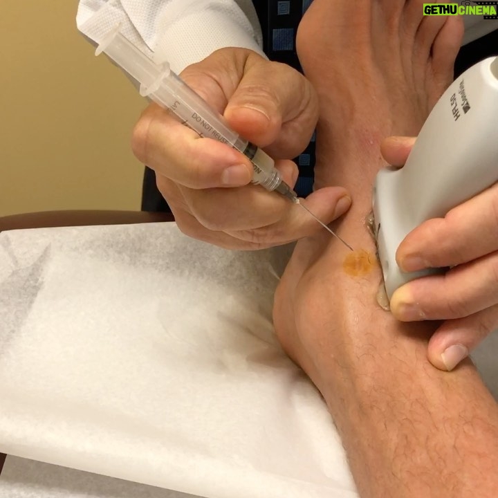Danny Way - 3.4K Likes - I have had 28 orthopedic surgeries now which 21 were performed by @drwilliamprevite . When your in the business of getting hurt the resources like relationships with your doctors, and the education you acquire along the way becomes the crux to the longevity and success of your career. I wouldn’t have made it past 30 without Dr.Previte and @paul.chek . Paul introduced me to Dr. Previte in 1997 when I blew my ACL for the first X and the rest is history. @bioxcellerator_