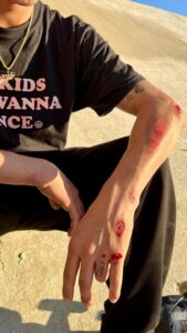 David Loy Instagram - ROLLED ANKLE   ROAD RASH 
🤘🏼🩸 Concrete isn’t always friendly. 
You can hear my skin scrape off.