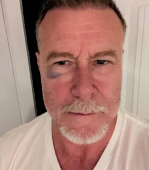Dean McDermott Instagram - Got clipped with a high stick today. I’m pretty sure it was @chefsangyoon Ok, it wasn’t him, I just like to blame him for everything. Being sober, I appreciate my beloved game of hockey even more. Ken Dryden said, “hockey doesn’t build character, it reveals it”. I sure have met a lot of characters in my 50 years of playing. Hockey is my Church!! Best Game EVER!!!! #sober #hockey
