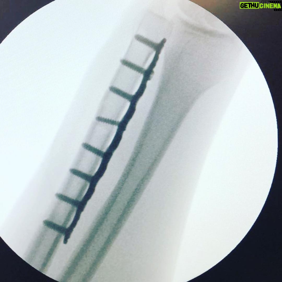 Diego Muñoz - 19.3K Likes - 11 días después, haciendo abandono total del inmueble. Sin ningun tubo conectado al cuerpo / Casi un milagro. Gracias infinitas a todas las personas q me salvaron la vida. Gracias❤️ Ahora a recuperarme bien.