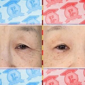 Donguri Instagram - テレビ朝日
「今田耕司★ヒットの世界 東大生が通販してみた!第7弾」
2022年3月13日(日)
15:20〜16:15 

スッピンで🙏

韓国美容液凄い！

三角の目が！
シワが！

毎日奇跡❣️💕
今日も最幸最強❣️💕❤️