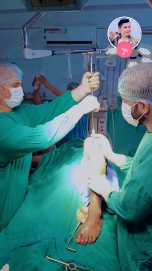 Dr. Sandesh Lamsal Instagram - “Talent creates your path, determination enlightens it, and your passion colors the journey.” - #DrSandeshLamsal
.
.
.
.
This is the first solo OT (IMIL Nail Removal from Left Tibia) performed by Dr. Lamsal under the guidance of Dr. Hem Raj Sharma (@dr.hemrajsharma), Senior Orthopaedics & Trauma Surgeon of Rapti Provincial Hospital, Tulsipur, Dang.
.
.
.
Keywords: [Quotes], [Solo OT], [IMIL Nail Removal], [Dr. Sandesh Lamsal], [Dr. Hem Raj Sharma], [Orthopaedics Surgeon], [Trauma Surgeon], [Rapti Provincial Hospital], [Tulsipur], [Dang], [Nepali Doctor], [Nepalese Internet Celebrity], [Orthopaedics], [Surgery], [Operation], [MedGram], [Medical Creator], [Born On Instagram], [BOI], [Surgeon], [Proud Moment], [Proud Doctor], [Doctor], [Nepal], [Implant Removal], [Tibia], [Nail], [Orthopedic Surgeon]
.
.
.
#NepaliDoctor #NepaleseInternetCelebrity #Orthopaedics #Trauma #Surgery #OT #Operation #MedGram #MedicalCreator #BornOnInstagram #BOI #Creator, #Surgeon #ProudMoment #DrHemRajSharma #ProudDoctor #Doctor #Dang #Tulsipur #Nepal #ImplantRemoval #Tibia #Nail #orthopedicsurgeon #orthopedics #RaptiProvincialHospital