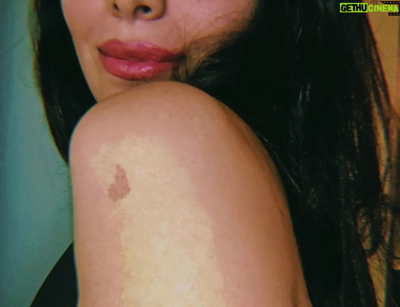 Ebru Aytemur - 3 Likes - Birthmark❤️