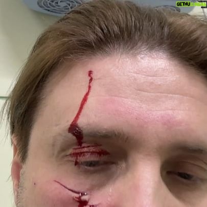 Edgard Zapashnyy - 10.1K Likes - The first video I recorded shortly before my injury. There I’m sitting with Roy and one day later he hooked me exactly his left paw!
If you have claws, sometimes you can use them 😁
Roy is not to blame, it’s only my mistake - I was distracted at the wrong time and didn’t t see how Roy jumped from another tiger in my direction.
Sometimes it happens - it's just an accident.
Roy I love you ❤️
Первое видео я записал незадолго до своей травмы. Именно на нем я сижу вместе с Роем, и зацепил он меня как раз этой самой левой лапой !
Раз когти есть, то ими можно иногда пользоваться 😁
Рой не виноват,виноват я сам - отвлекся не вовремя и не увидел, как Рой отпрыгнул от другого тигра в мою сторону.
Такое бывает - просто несчастный случай.
Роя люблю и дальше ❤️
#ялюблютебяжизнь #такаяработа #запашный #цирк#circusaccident #zapashnybrotherscircus #roy #mytiger #shithappens
