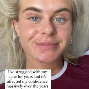 Emily Barker Instagram - Saw this trend on insta and felt it was time to add a bit of reality into my page again … so let’s keep it real for a sec shall we 🤍💫🫶🏼