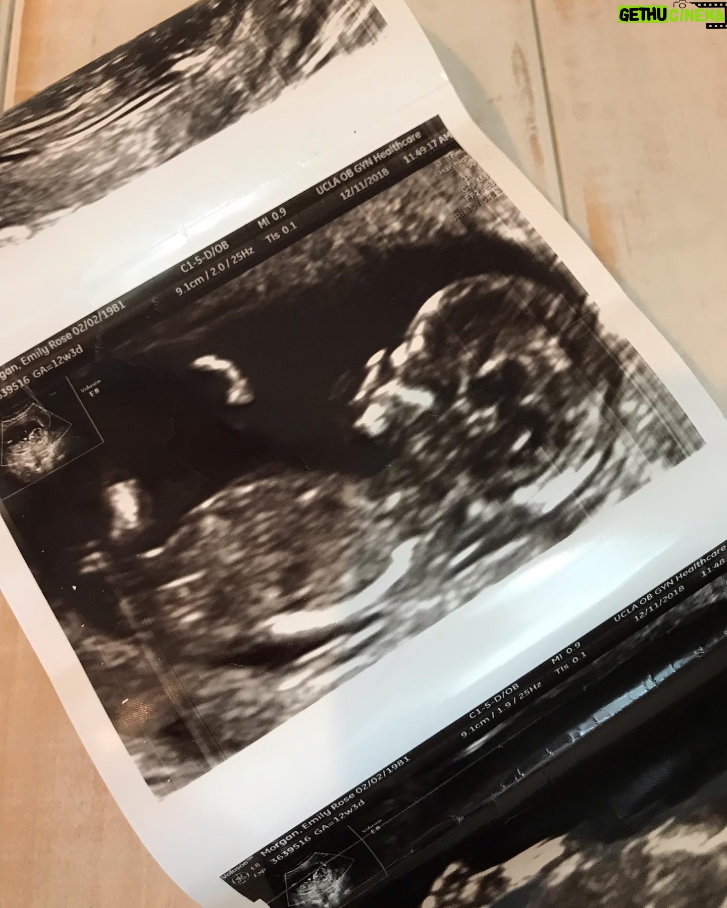 Emily Rose - 8K Likes - So we have been keeping this under wraps, online because....well if I am being honest I didn’t want to affect work if I announced... however NOW we are very excited to announce that we are having a little girl in June 2019!! No more hiding this baby and no more wanting too:) I am so grateful for the work I just finished and grateful for the timing of the work to come! Knowing though that ultimately the greatest gift is life... and being able to bring a sweet little baby into the world! That’s the most important work for me during this time. We can’t wait to meet her and can’t wait to add a little lady to our tribe ❤️❤️❤️ first pic second trimester, next pic third 😂 so close to meeting this thistle sweet pea!