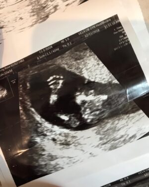 Emily Rose Instagram - So we have been keeping this under wraps, online because....well if I am being honest I didn’t want to affect work if I announced... however NOW we are very excited to announce that we are having a little girl in June 2019!! No more hiding this baby and no more wanting too:) I am so grateful for the work I just finished and grateful for the timing of the work to come! Knowing though that ultimately the greatest gift is life... and being able to bring a sweet little baby into the world! That’s the most important work for me during this time. We can’t wait to meet her and can’t wait to add a little lady to our tribe ❤️❤️❤️ first pic second trimester, next pic third 😂 so close to meeting this thistle sweet pea!