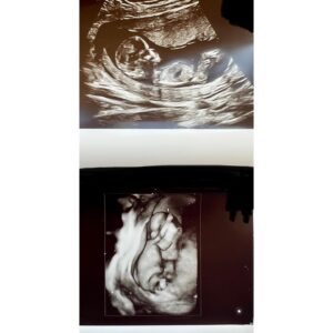 Erik Griffin Instagram - It’s official!! We’re having a baby boy!! 🩵 So exciting!!
